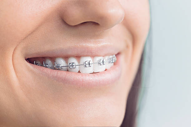 Best Tooth Extraction  in Frisco, TX